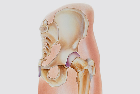 STABILITY FOR HYPERMOBILITY – Access–Centered Movement